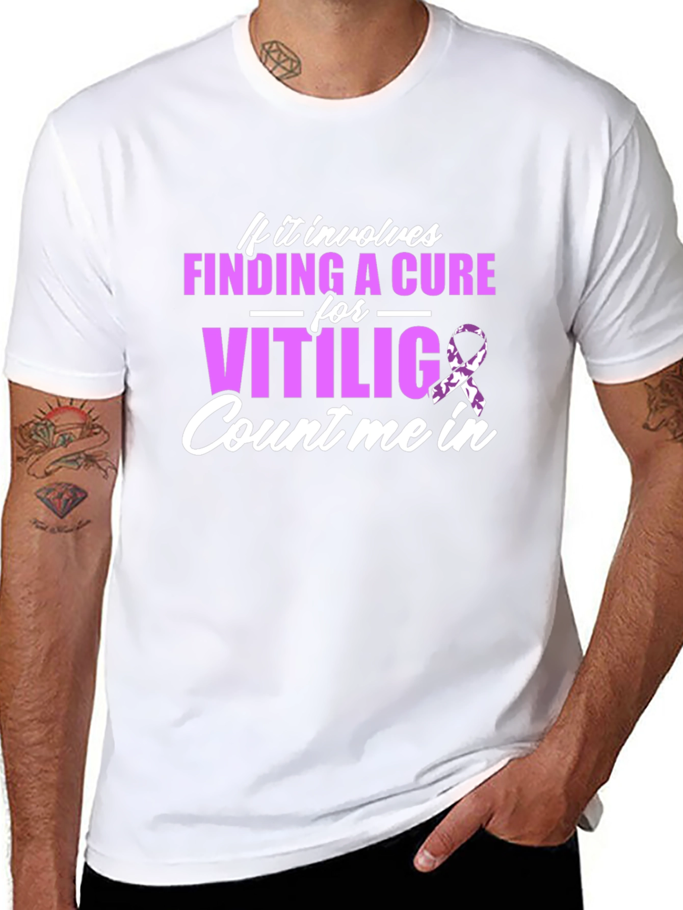Vitiligo Cure Awareness T-Shirt